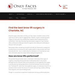 Brow lift surgery from Charlotte, NC’s top Facial Surgeon.