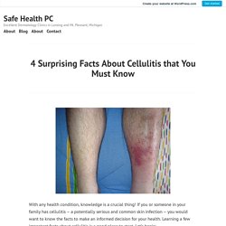 4 Surprising Facts About Cellulitis that You Must Know – Safe Health PC