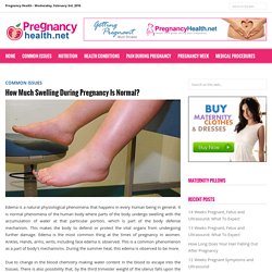 How Much Swelling During Pregnancy Is Normal