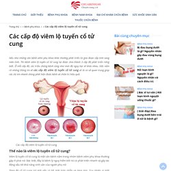 [Tất tần tật]Các cấp độ viêm lộ tuyến cổ tử cung thường gặp ở nữ giới