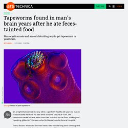 Tapeworms found in man’s brain years after he ate feces-tainted food