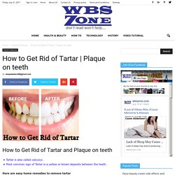 How to Get Rid of Tartar and Plaque on teeth Tartar is also called calculus