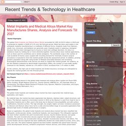 Recent Trends & Technology in Healthcare: Metal Implants and Medical Alloys Market Key Manufactures Shares, Analysis and Forecasts Till 2027