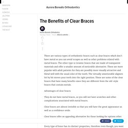The Benefits of Clear Braces