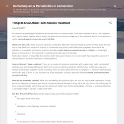 Things to Know About Tooth Abscess Treatment