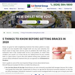 5 Things To Know Before Getting Braces In 2020