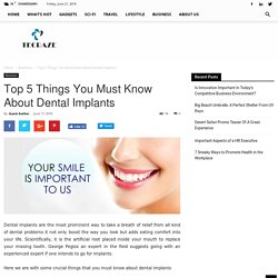 Oral Health Tips For Dental Implant Surgery -George Pegios