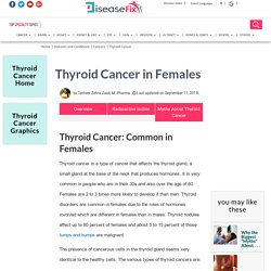 Thyroid Cancer Symptoms in Females