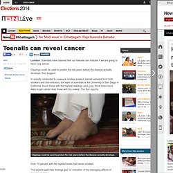 Toenails can reveal if you have cancer - Trends News