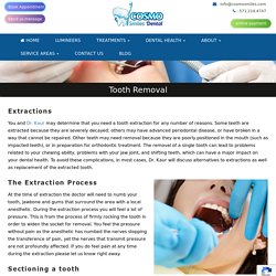 Tooth Removal