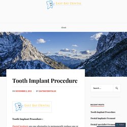 Tooth Implant Procedure