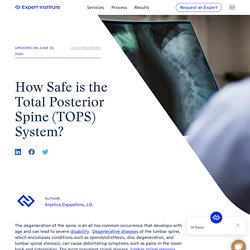 How Safe is the Total Posterior Spine (TOPS) System?