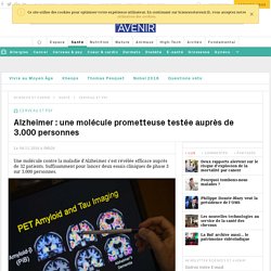 Alzheimer : un traitement expérimental prometteur va être testé sur 3.000 patients