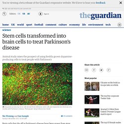 Stem cells transformed into brain cells to treat Parkinson's disease