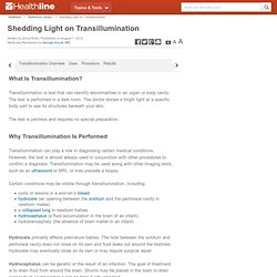 Transillumination: Shining Light on Your Organs