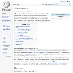 Face transplant - Wikipedia, the free encyclopedia - (Build 20100722150226)