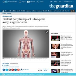 First full body transplant is two years away, surgeon claims