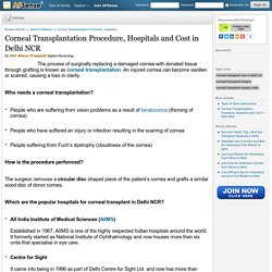 Corneal Transplantation Procedure, Hospitals and Cost in Delhi NCR - MedMonks