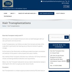Hair Transplantations - Hair Loss Treatment in Gujarat