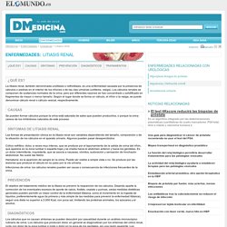 Litiasis renal tratamientos, síntomas e información en Dmedicina