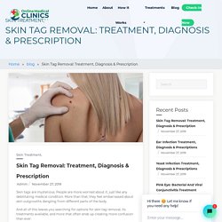 Skin Tag Removal Treatment, Diagnosis & Prescription - Online Medical Clinic