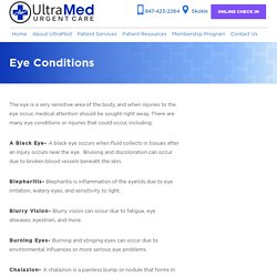 Eye Treatment in Skokie, IL