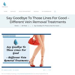 Say Goodbye To Those Lines For Good – Different Vein Removal Treatments