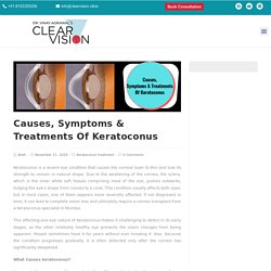 Causes, Symptoms & Treatments Of Keratoconus