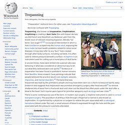 Trepanning