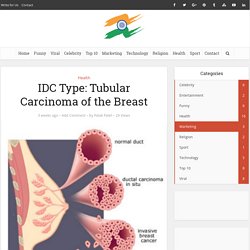 IDC Type: Tubular Carcinoma of the Breast (Type of Breast Cancer)