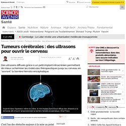 Tumeurs cérébrales : des ultrasons pour ouvrir le cerveau