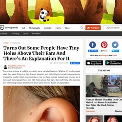 Turns Out Some People Have Tiny Holes Above Their Ears And There's An Explanation For It