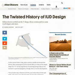 The Twisted History of IUD Design - Atlas Obscura