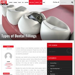 Types of Dental Fillings