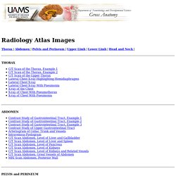 Gross Anatomy X-ray Atlas