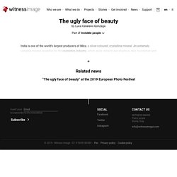The ugly face of beauty