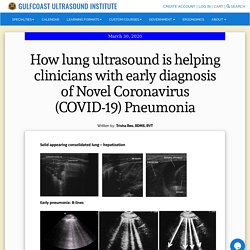 How lung ultrasound is helping clinicians with early diagnosis of Novel Coronavirus (COVID-19) Pneumonia - Gulfcoast Ultrasound News Blog