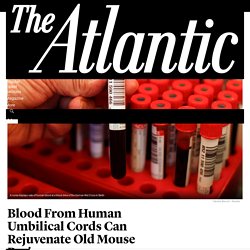 Blood From Human Umbilical Cords Can Rejuvenate Old Mouse Brains - The Atlantic