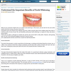Understand the Important Benefits of Teeth Whitening by Liza smith