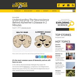 Understanding The Neuroscience Behind Alzheimer's Disease in 2 Minutes