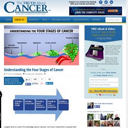 Understanding the Four Stages of Cancer