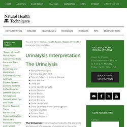 Urinalysis Interpretation