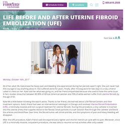 Before and After Uterine Fibroid Embolization
