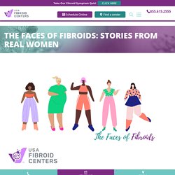 Uterine Fibroid Stories and Experiences Shared by Real Women