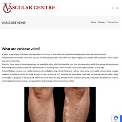 Varicose Vein Specialist in Bangalore - Vascular Centre