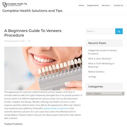 A Beginners Guide To Veneers Procedure