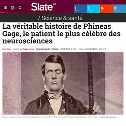 La véritable histoire de Phineas Gage, le patient le plus célèbre des neurosciences