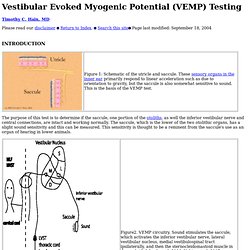 Vestibular evoked myogenic potential