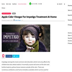 Apple Cider Vinegar For Impetigo Treatment At Home