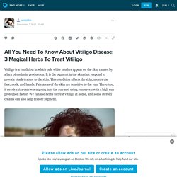 All You Need To Know About Vitiligo Disease: 3 Magical Herbs To Treat Vitiligo : kenloftin — LiveJournal